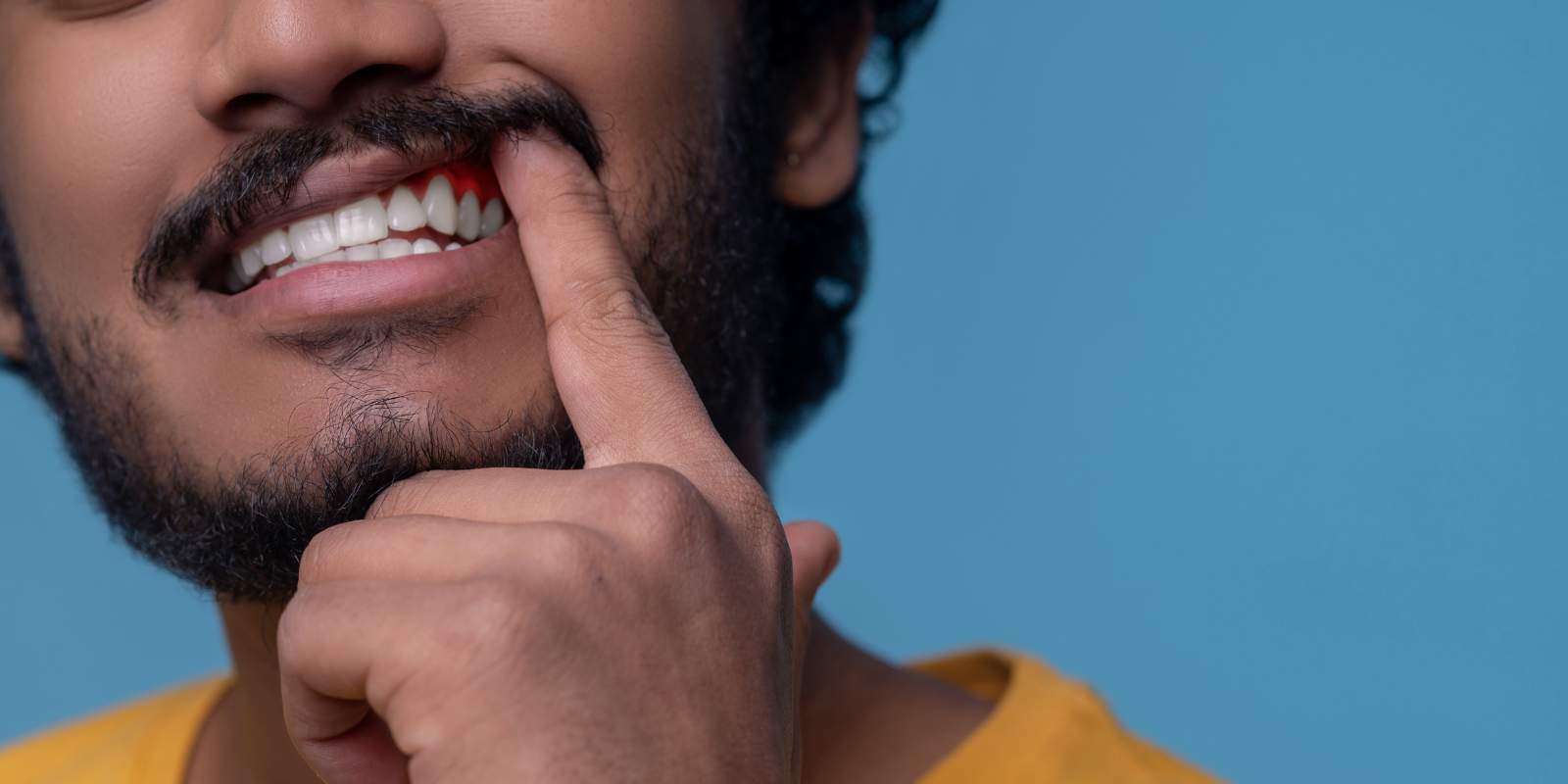 пародонтоз